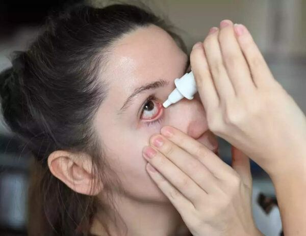 Twitter Filled With Conjunctivitis Memes
