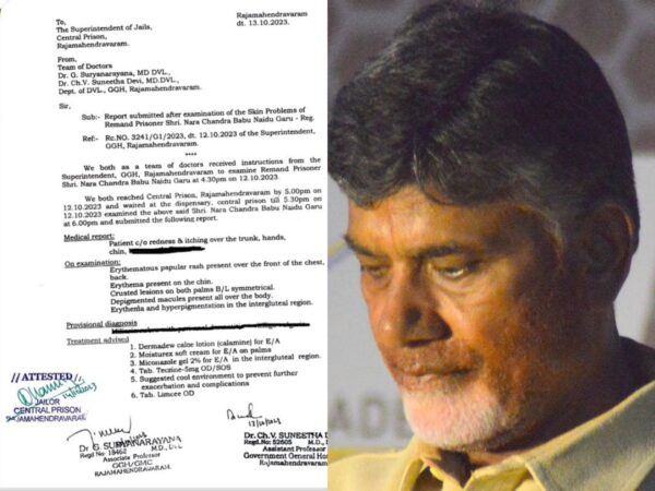 chandrababu medical report