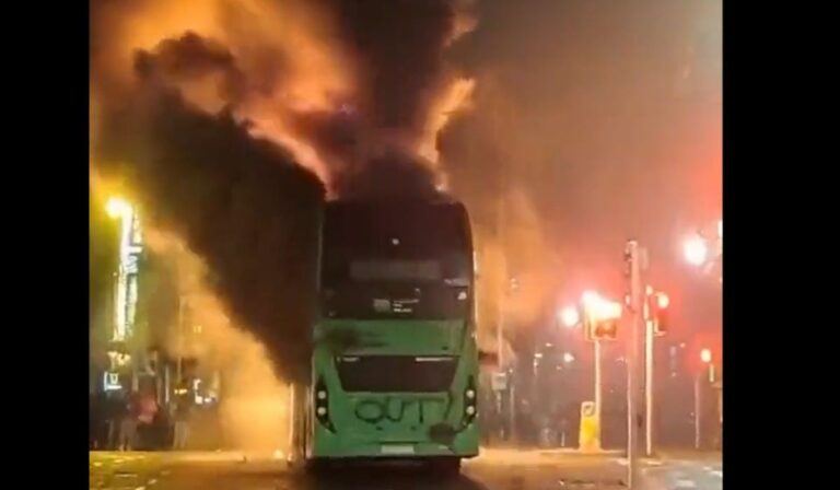 Burn Immigration Centers
