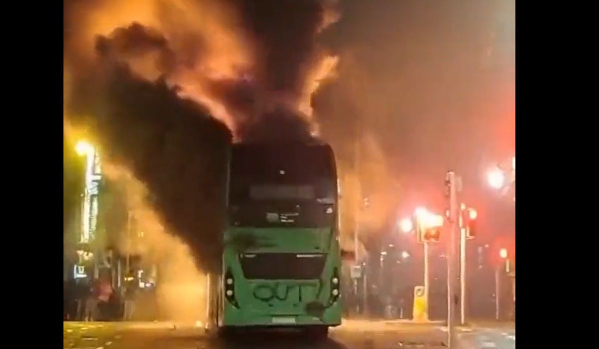 Burn Immigration Centers