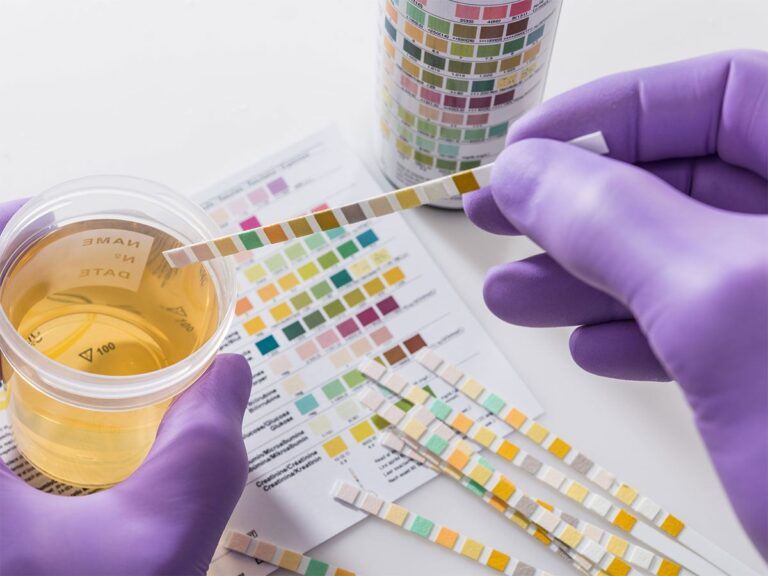 drug-detection-tests