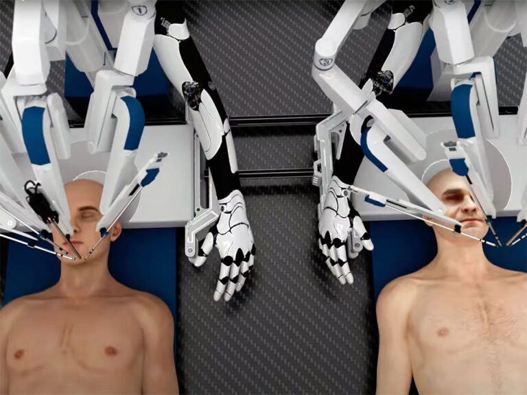 Head Transplant