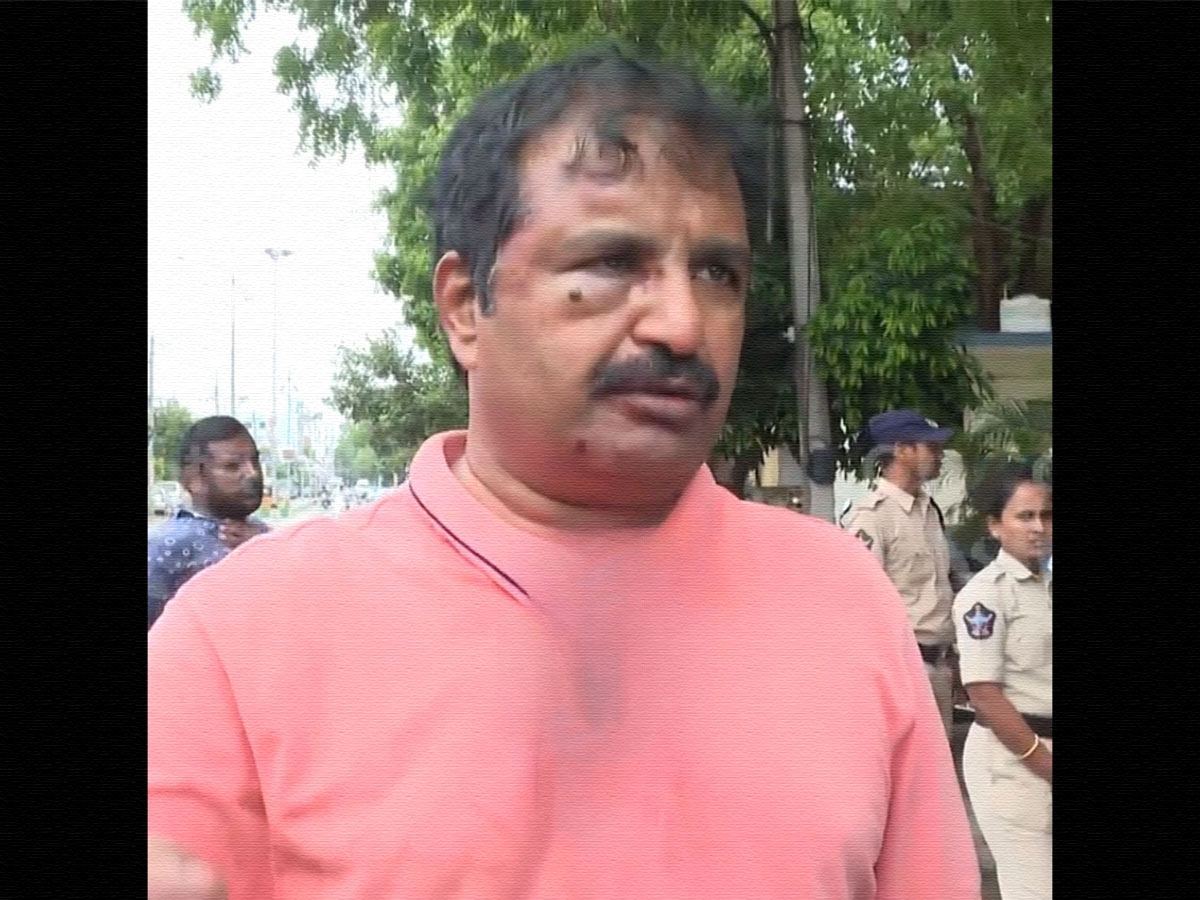 Tenali Voter Revolt: Victim Reveals What Happened