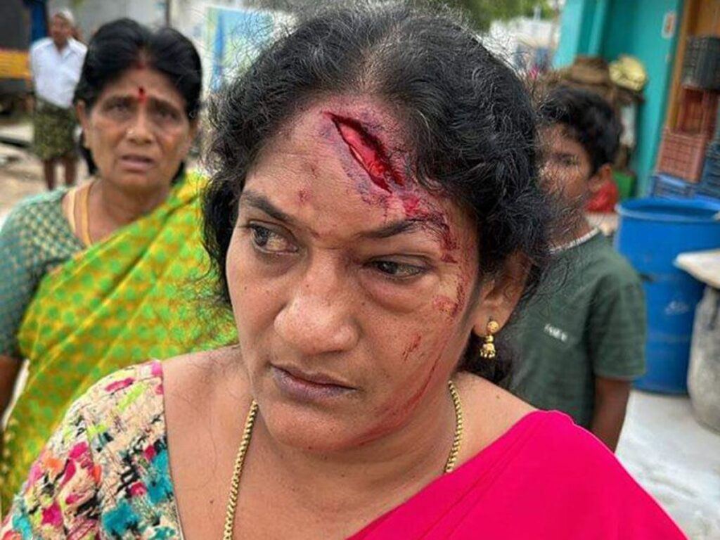 woman-injured-in-palnadu