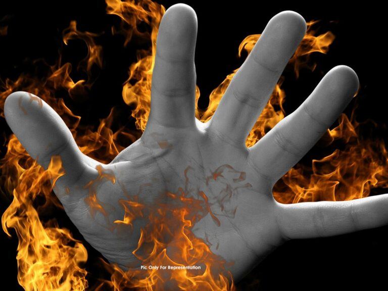 Pakistani Origin Man Set On Fire in Canada!