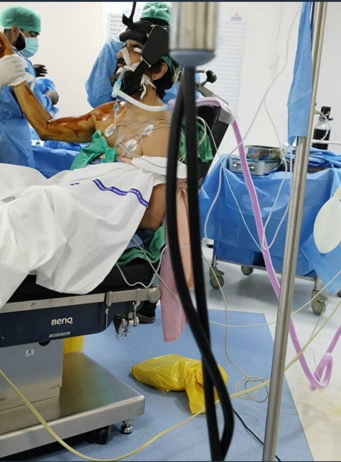 scary-picture-of-ravi-tejas-accident---real-or-fake