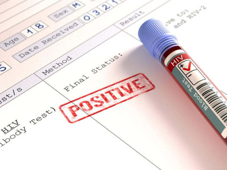 hiv-positive