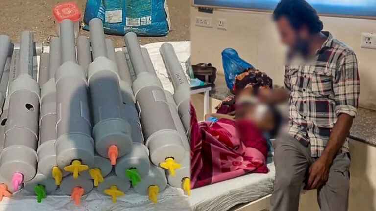 Diwali carbide gun blast injuries in children