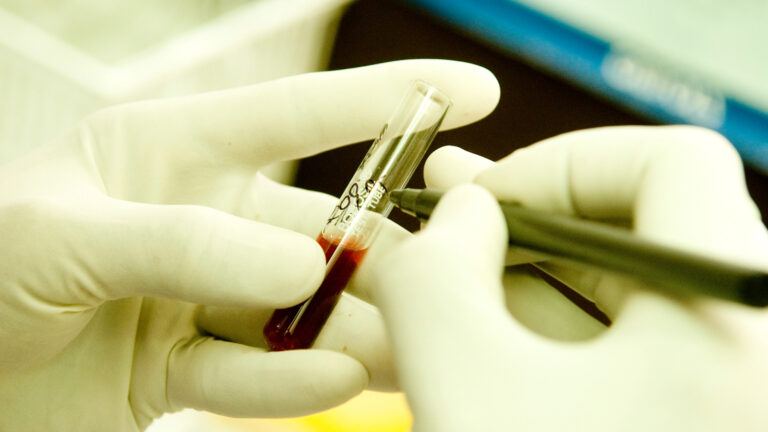 Jharkhand hospital HIV transfusion case