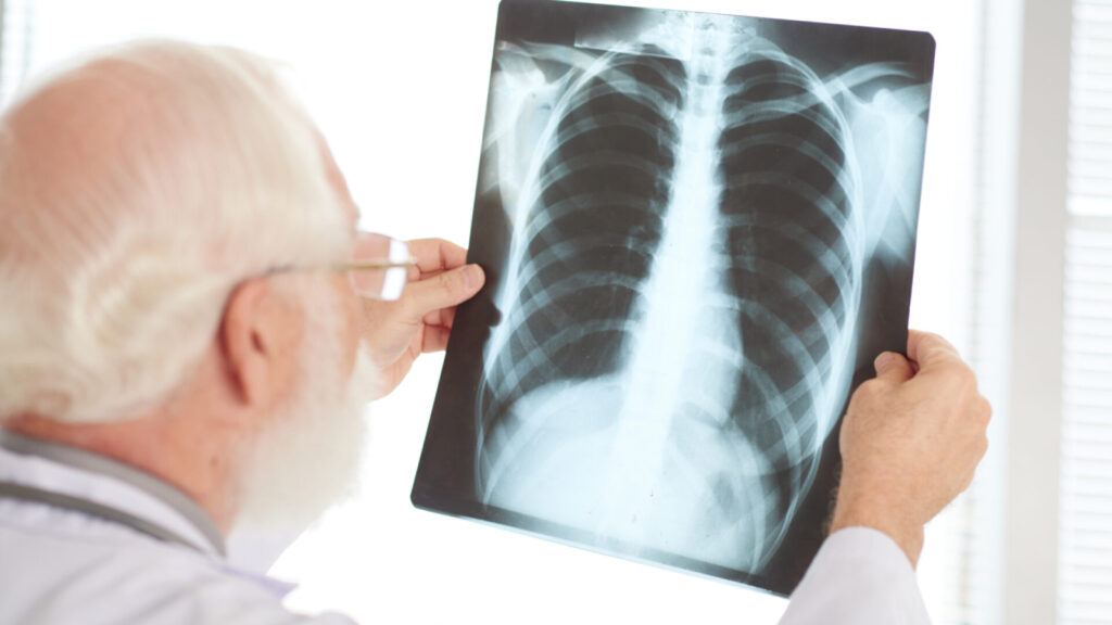 Man misdiagnosed with cockroach in heart