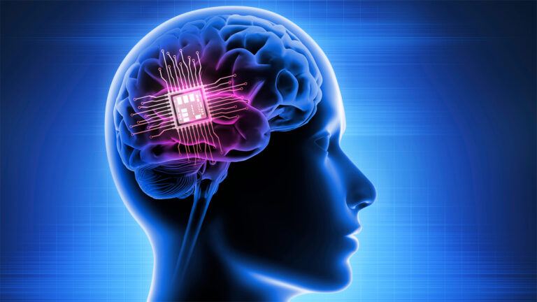 Neuralink brain implant technology update